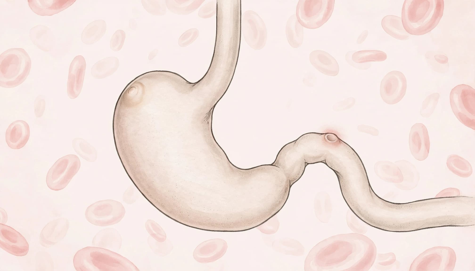 A stomach and upper digestive tract with a small highlighted ulcer and faint red blood cell shapes.