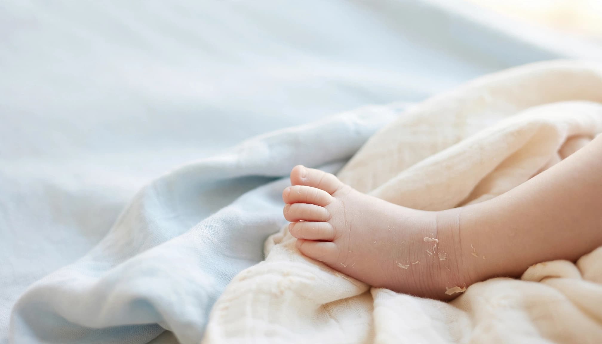A newborn baby's foot with mild peeling skin rests on a soft blanket.