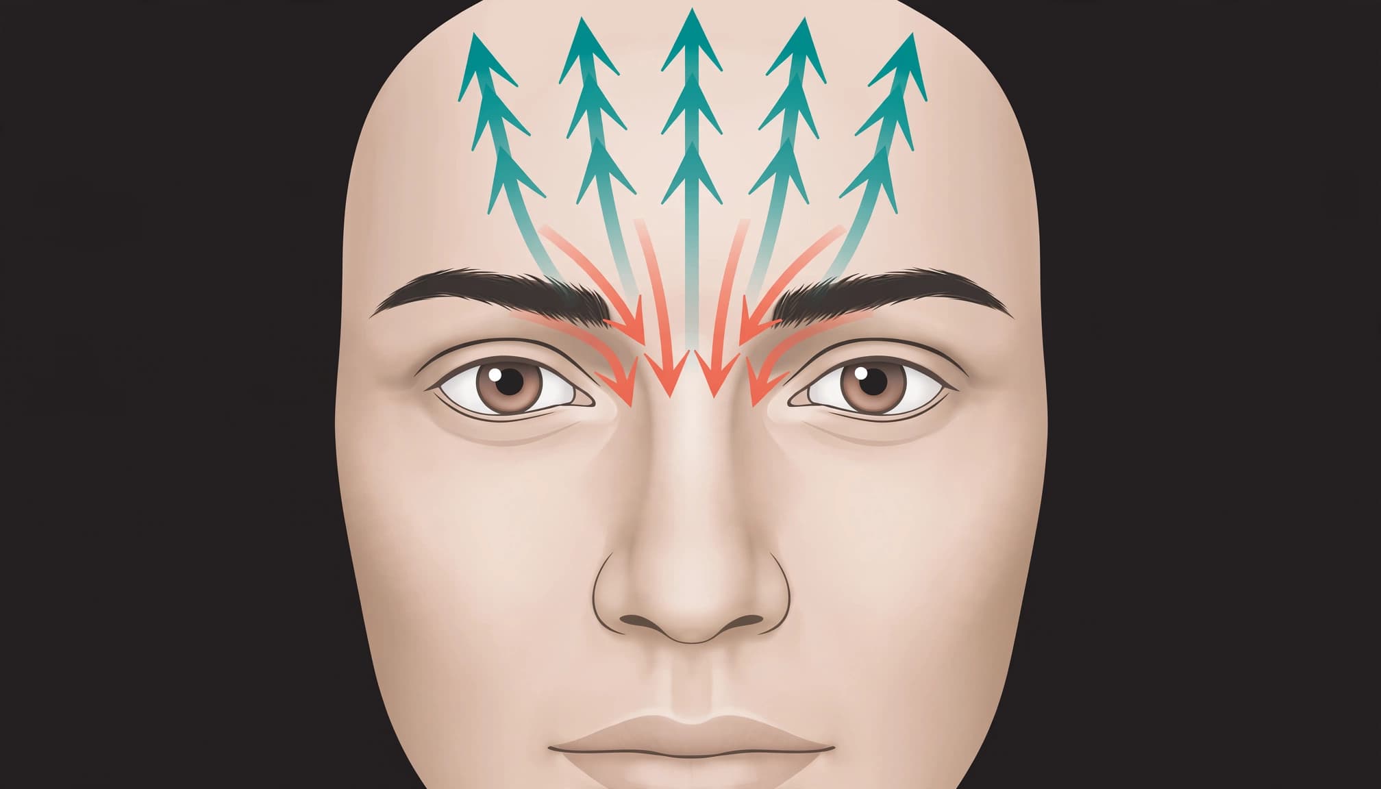 Front-facing face showing forehead and brow muscle directions on a dark background.